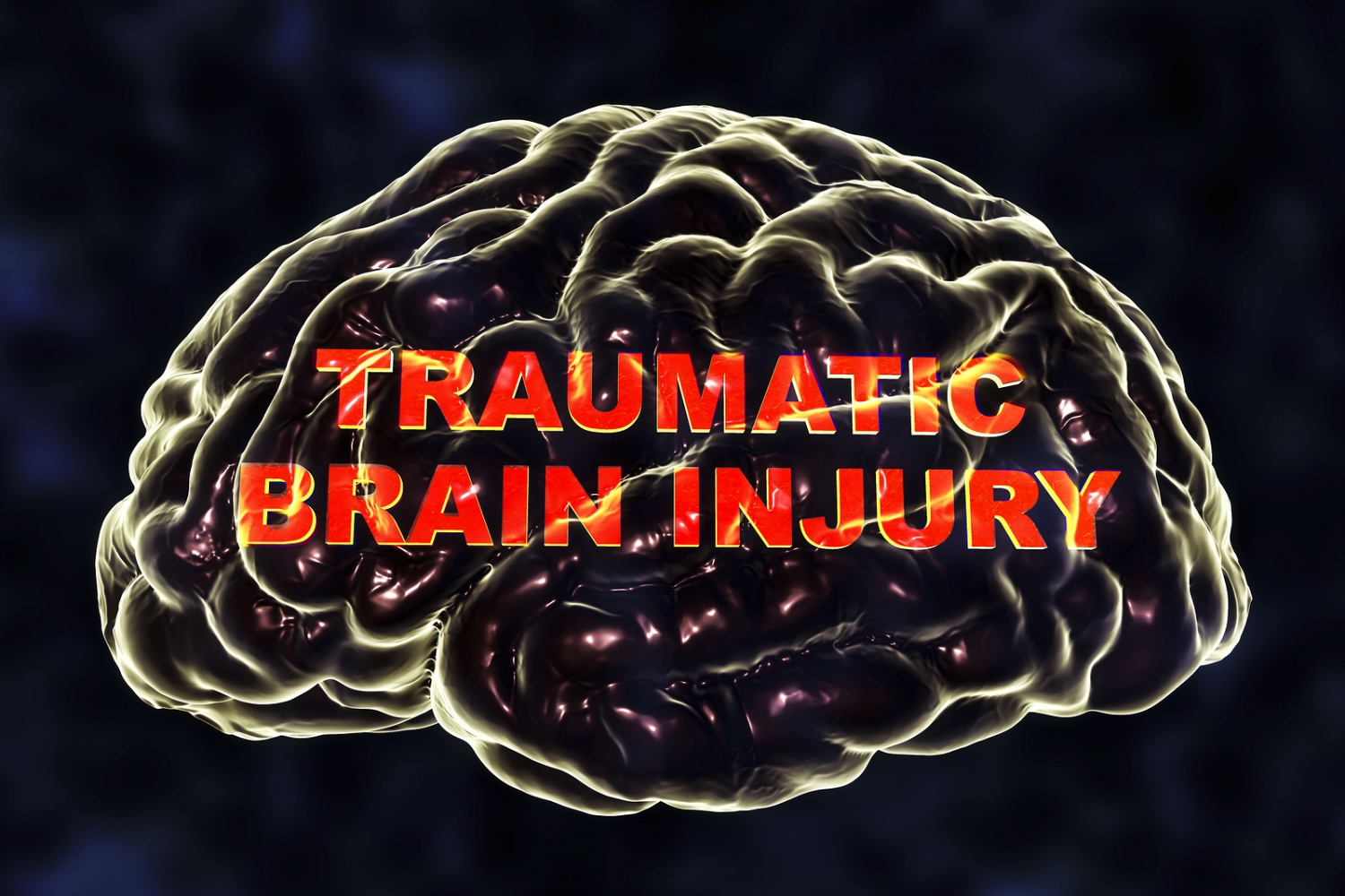 cdc-study-shows-traumatic-brain-injuries-following-slip-and-fall