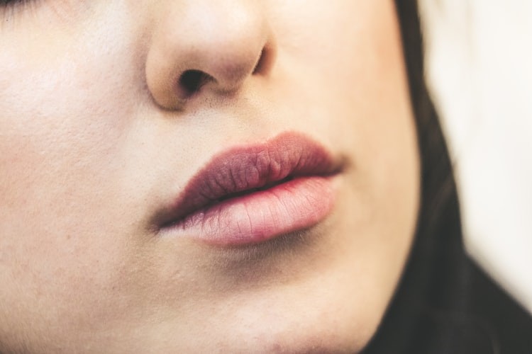 Lip inflammation