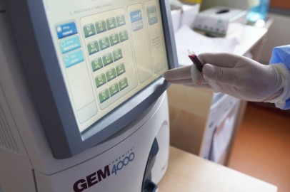 A First of Its Kind Alzheimer's Blood Test Goes on Sale