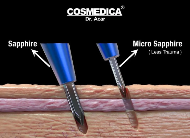 Hair Transplant Turkey Before and After: What you need to know