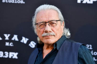 Edward James Olmos, Latino Acting Legend, Reveals He Had Throat Cancer