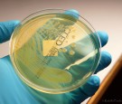 Certain bacteria can even outlast Antibiotic  