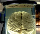 Brains in a Jar May Help Fight Disease