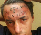 Brazil Teenager Inked on Forehead