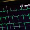Heart control Monitor