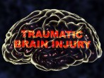 CDC Study Shows Traumatic Brain Injuries Following Slip and Fall Accidents is Increasing  