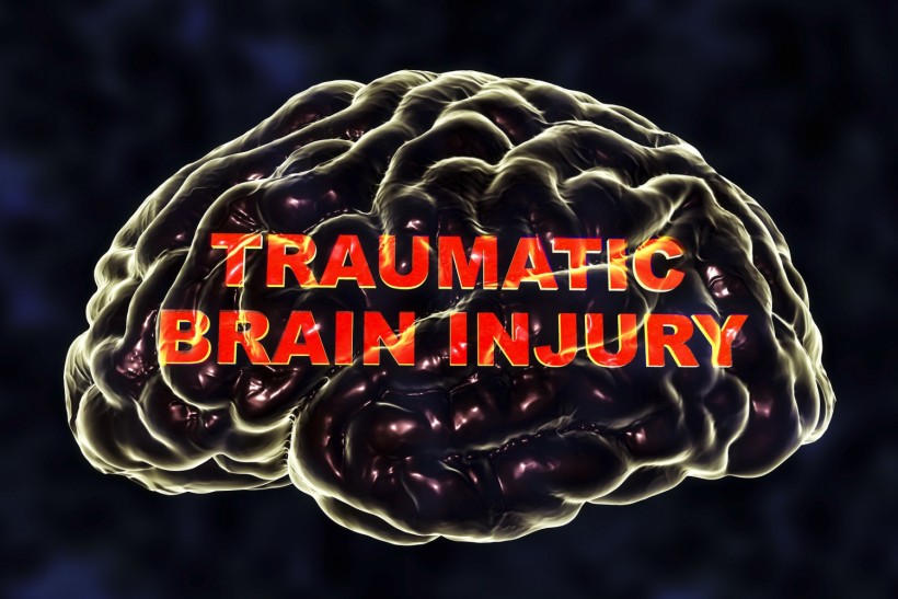 CDC Study Shows Traumatic Brain Injuries Following Slip and Fall Accidents is Increasing  
