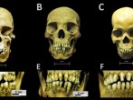 Skulls and dental decoration patterns for the three African individuals from the San José de los Naturales Royal Hospital