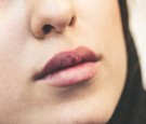 Lip inflammation