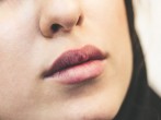 Lip inflammation