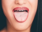 COVID Tongue