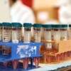 Can Cuba Become the 1st Country in Latin America to Develop Its Own COVID Vaccine?