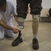 Amputee Boxer Wearing a Prosthetic Leg to Set Foot on Ring for First Professional Fight