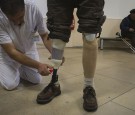 Amputee Boxer Wearing a Prosthetic Leg to Set Foot on Ring for First Professional Fight