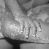 Monkeypox Vaccine for Children: Here's What Every Concerned Parent Should Know