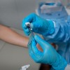Monkeypox in Babies? Florida Records First Pediatric Case Amid Growing Threat of Virus