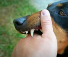 Vicious dog showing teeth and biting hand