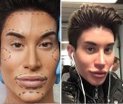 Human Ken Doll justin Jedlica plastic surgery