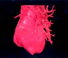 Three Dimensional (3 D Image Displays A Computerised Visualization Of A Human Heart