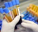 Israeli Laboratory Leads Western World In Blood Testing