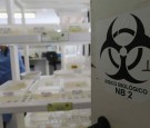 Brazil Faces New Health Epidemic As Mosquito-Borne Zika Virus Spreads Rapidly